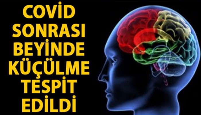 'Covid-19 geçirenlerin beyninde küçülme tespit edildi' (VİDEO)