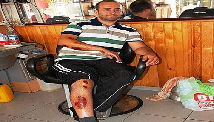 Evine giderken köpeklerin saldırısına uğradı