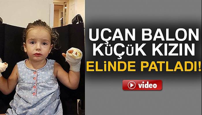 İçinde yanıcı gaz bulunan uçan balon küçük kızı yaktı