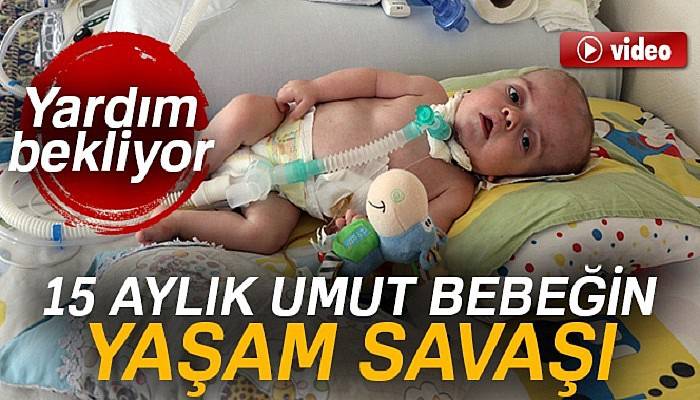 15 aylık umut bebek yardım bekliyor