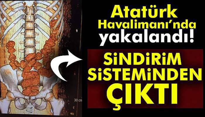  Sindirim sisteminden uyuşturucu çıktı