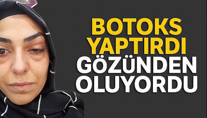 Botoks yaptırdı: Gözünden oluyordu