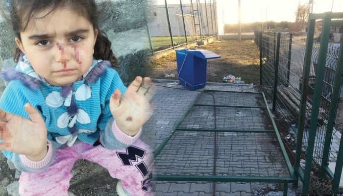 Geyikli’de ihmaller zinciri mi var? Çocuk yaralandı