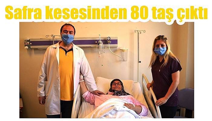 Safra kesesinden 80 taş çıktı