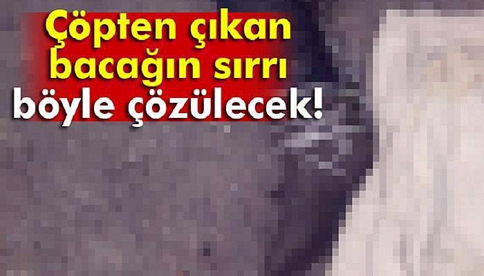 Çöpten çıkan bacağın sırrını kayıp başvuruları çözecek