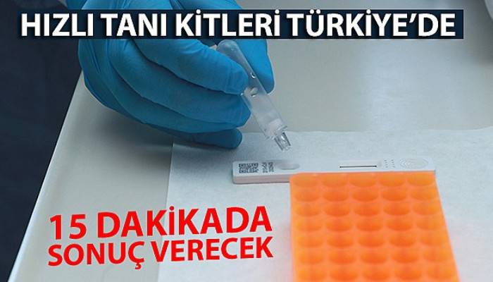 Hızlı tanı kitleri Türkiye'de