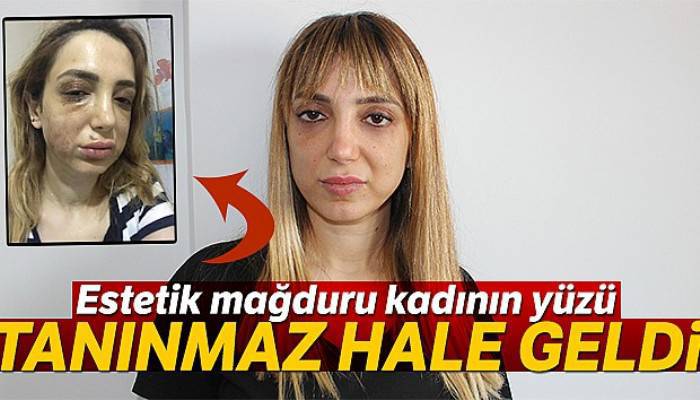 Estetik mağduru kadının yüzü tanınmaz hale geldi