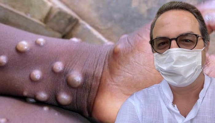 Şener'den Maymun Çiçeğine Karşı Korunma Uyarısı