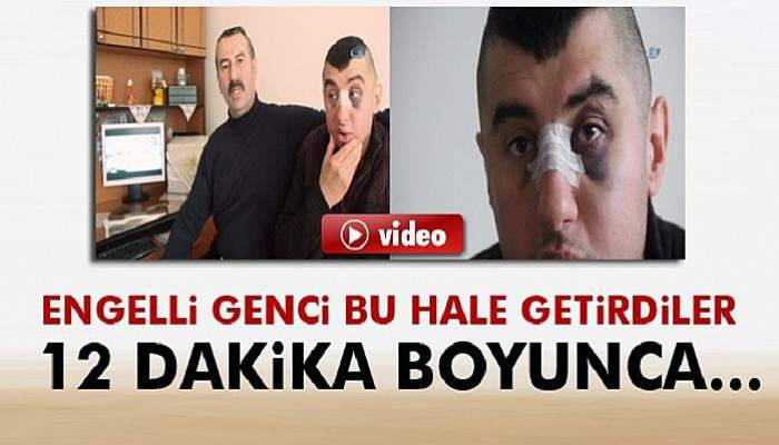 Zihinsel engelli gence dayak