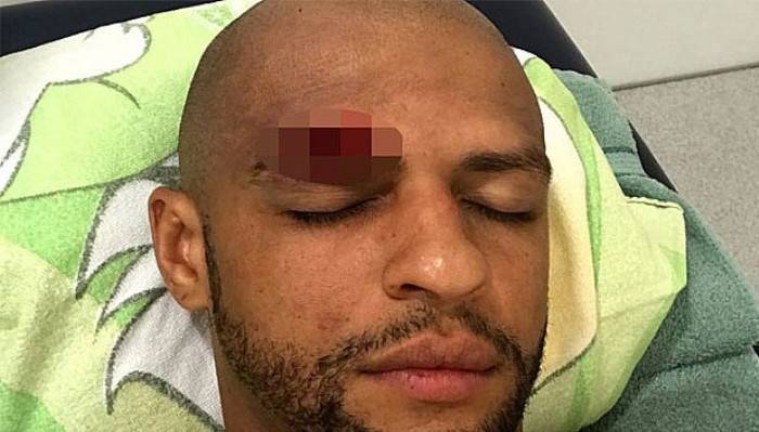 Felipe Melo'ya bakın ne oldu?