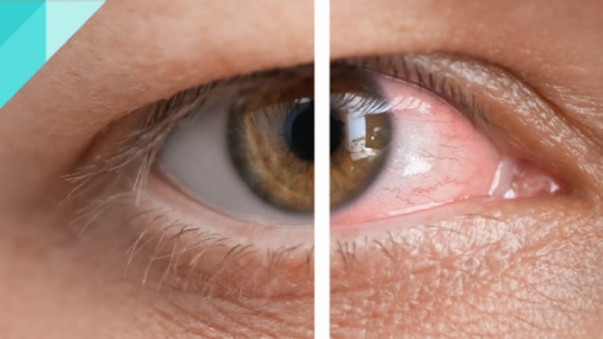 Retina Hastalıkları ve Vitroretinal Cerrahi