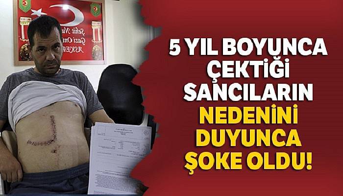 Karnında 5 yıl boyunca gazlı bez ile yaşadı