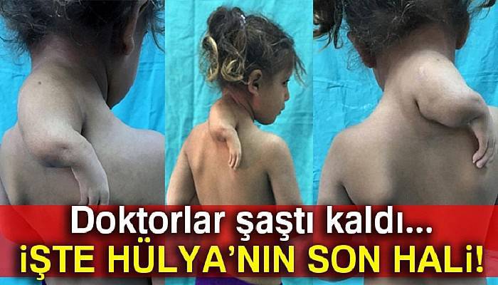  3. kolu boynunda dünyaya geldi