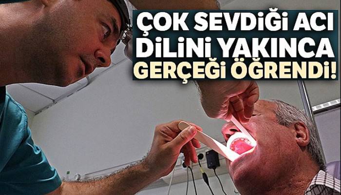 Çok sevdiği acı, dilini yakınca kanser olduğunu öğrendi