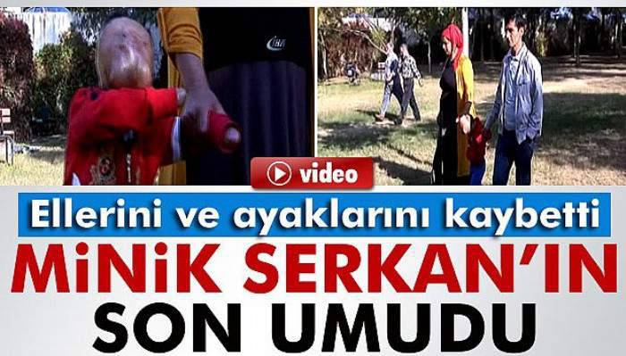 Minik Serkan’ın son umudu