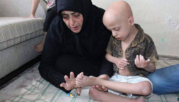 Suriyeli çocuğun iyileşmeyen hastalığı