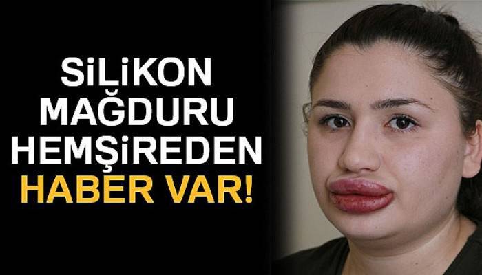  Silikon mağduru hemşireden haber var