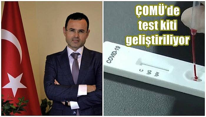 ÇOMÜ’de test kiti geliştiriliyor