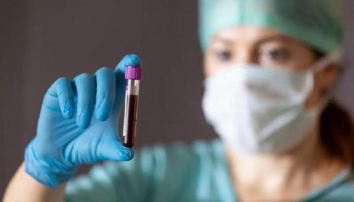BİLİM KURULU ÜYESİ PROF. DR. ŞENER UYARDI: TÜRKİYE'DE HIV VAKA SAYILARI 40 BİNE DAYANDI
