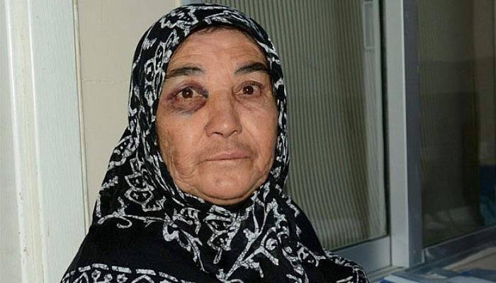 55 yıllık kocasından dayak yiyen kadın hastanelik oldu