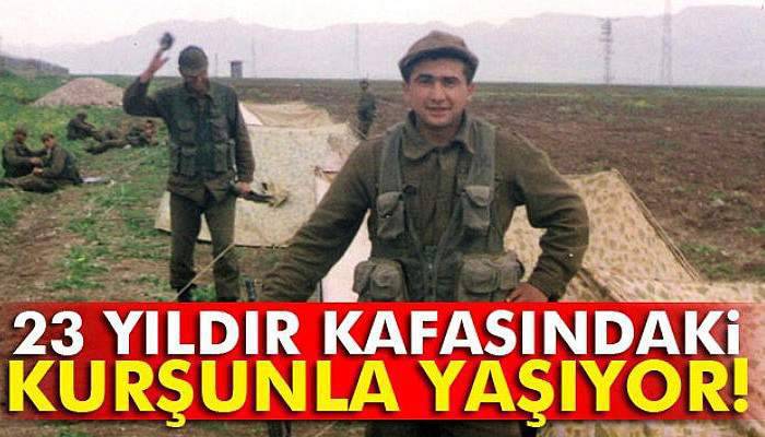 23 yıldır kafasındaki kurşunla yaşıyor