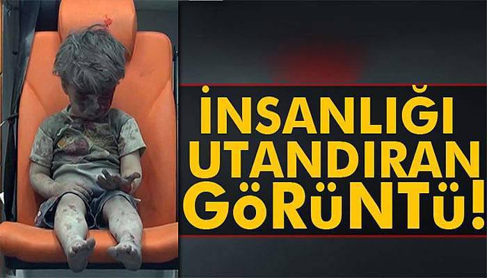 Enkazdan kurtarılan Suriyeli çocuğun insanlığı utandıran görüntüsü