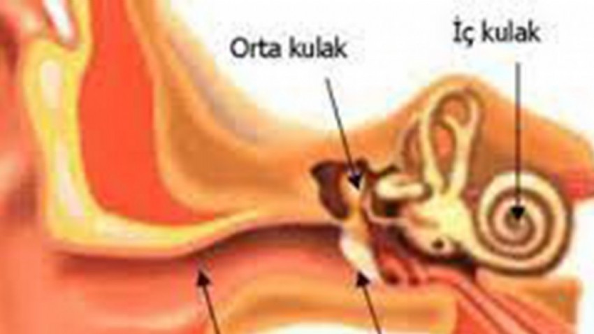 Orta Kulak İltihabı Nedir?