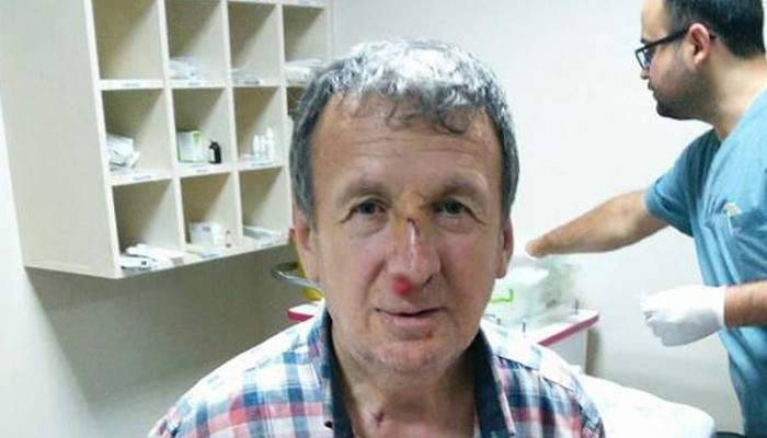 Bolu'da gazeteciye yumruklu saldırı