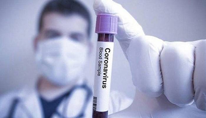 Rusya’dan umutlandıran koronavirüs açıklaması: 115 hasta iyileşti
