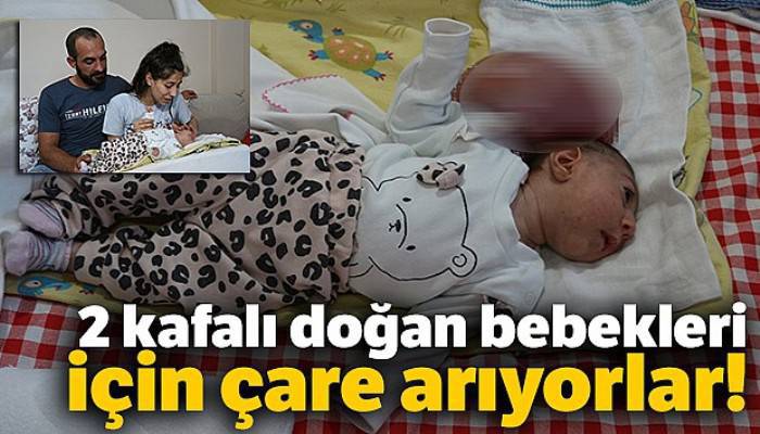 Doktorların 'Ölür' dedikleri 2 kafalı doğan bebekleri için çare arıyorlar