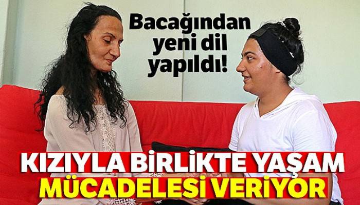 Bacağından yeni dil yapıldı! |Kızıyla birlikte yaşam mücadelesi veriyor