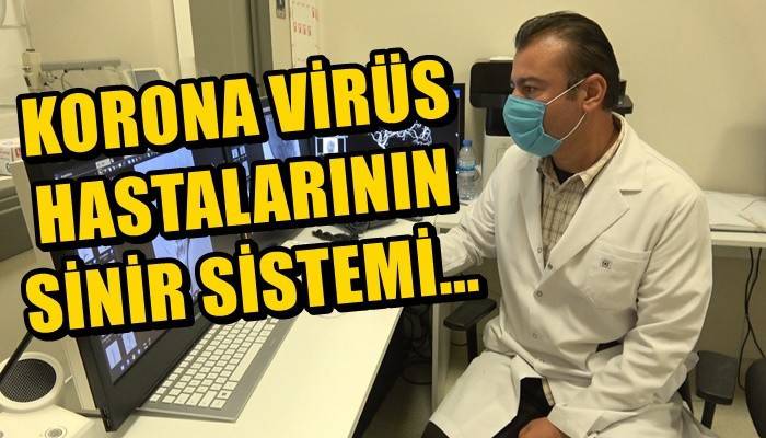 'Koronavirüs hastalarının 3'te 1'inde beyin ve sinir sistemi ciddi şekilde etkileniyor' (VİDEO)