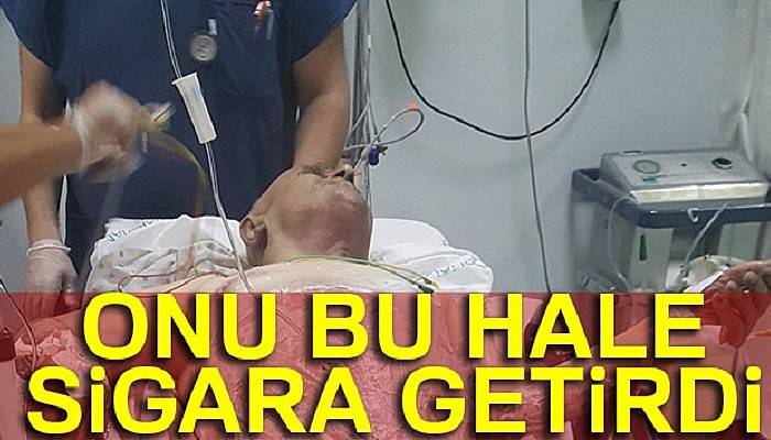 Sigaradan elbiseleri tutuştu, yanarak ağır yaralandı
