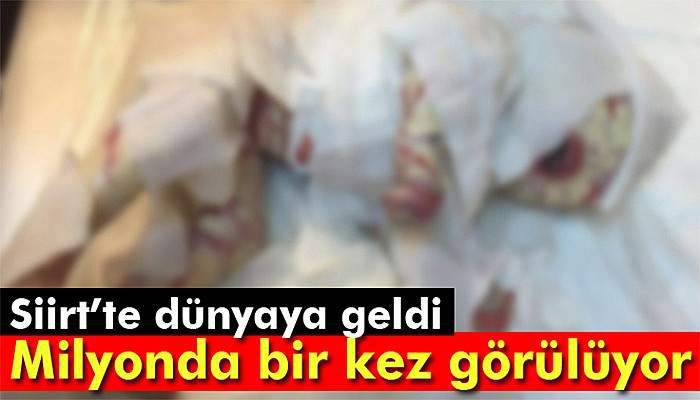 Siirt’te dünyaya geldi: Milyonda bir kez görülüyor