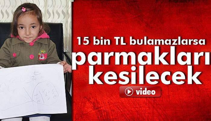  15 bin TL bulamazlarsa parmakları kesilecek