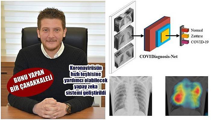 Koronavirüsün hızlı teşhisine yardımcı olabilecek yapay zeka sistemi geliştirildi