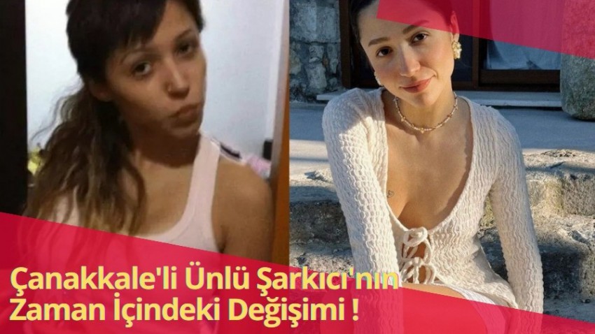 Çanakkaleli şarkıcı Zeynep Bastık'ın şaşırtan değişimi!