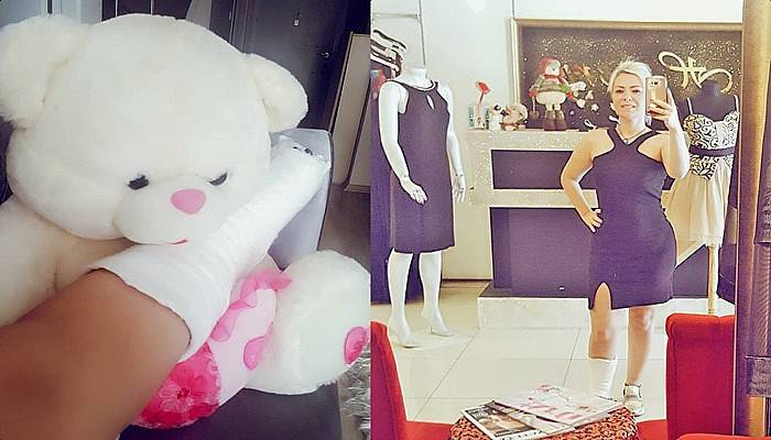 Sargılı Ayağı İle İşe Geldi