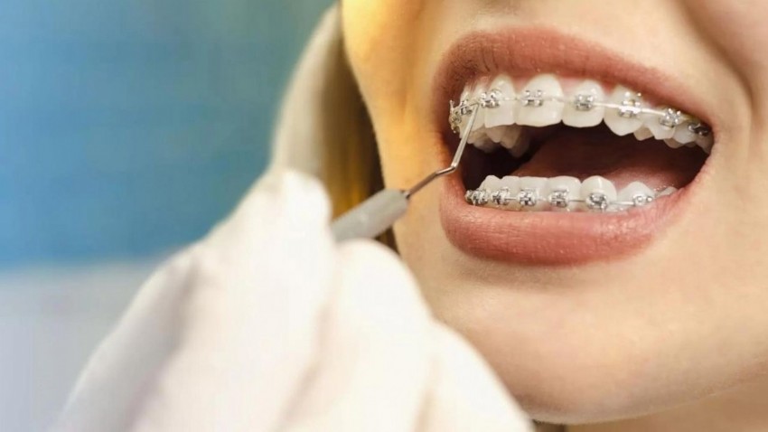 Ortodontik sorunlar öz güven problemlerine yol açabiliyor