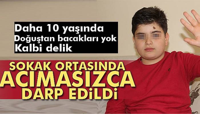 Doğuştan bacakları olmayan küçük Miraç, şehir magandalarının hedefi oldu