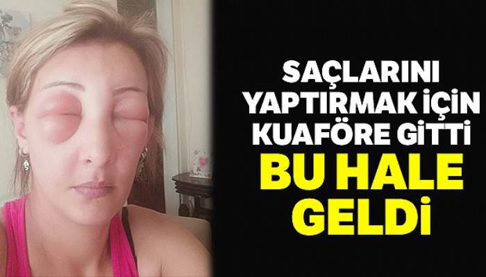Saçlarını yaptırmak için kuaföre gitti, canından oluyordu