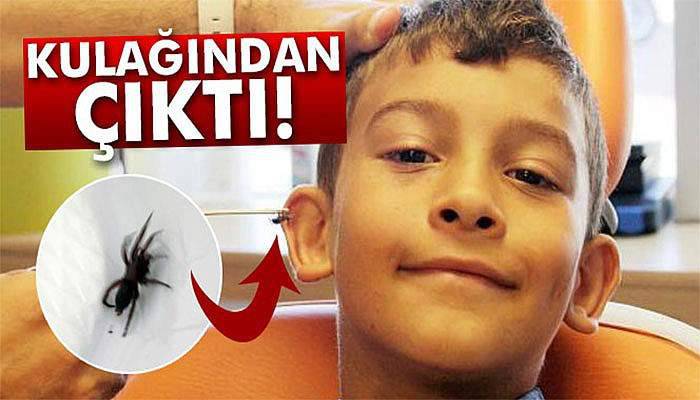 Kulağından canlı örümcek çıktı