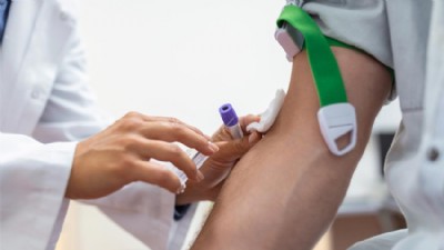 LH (Luteinizan Hormon) Nedir? LH Kaç Olmalı?
